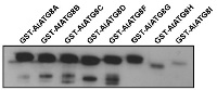 ATG8A-I | Autophagy-related protein 8A-I isoforms in the group Antibodies Plant/Algal / Protein Modifications / Autophagy-related and Ubiquitin-like Proteins at Agrisera AB (Antibodies for research) (AS14 2811)